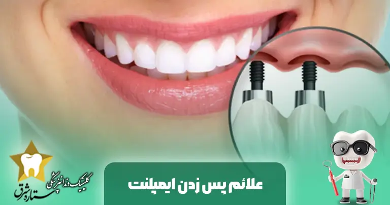 علائم پس زدن ایمپلنت