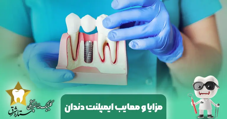 مزایا و معایب ایمپلنت دندان