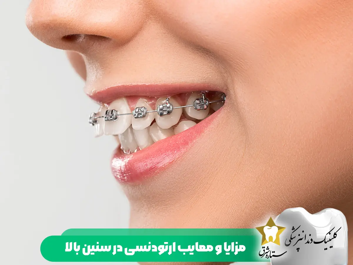 مزایا و معایب ارتودنسی در سنین بالا