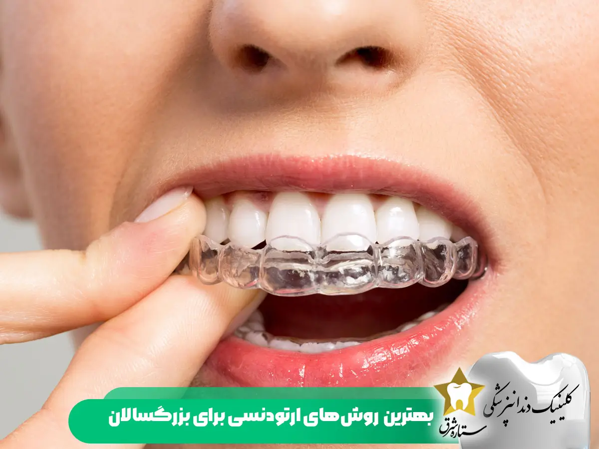 بهترین روش های ارتودنسی برای بزرگسالی