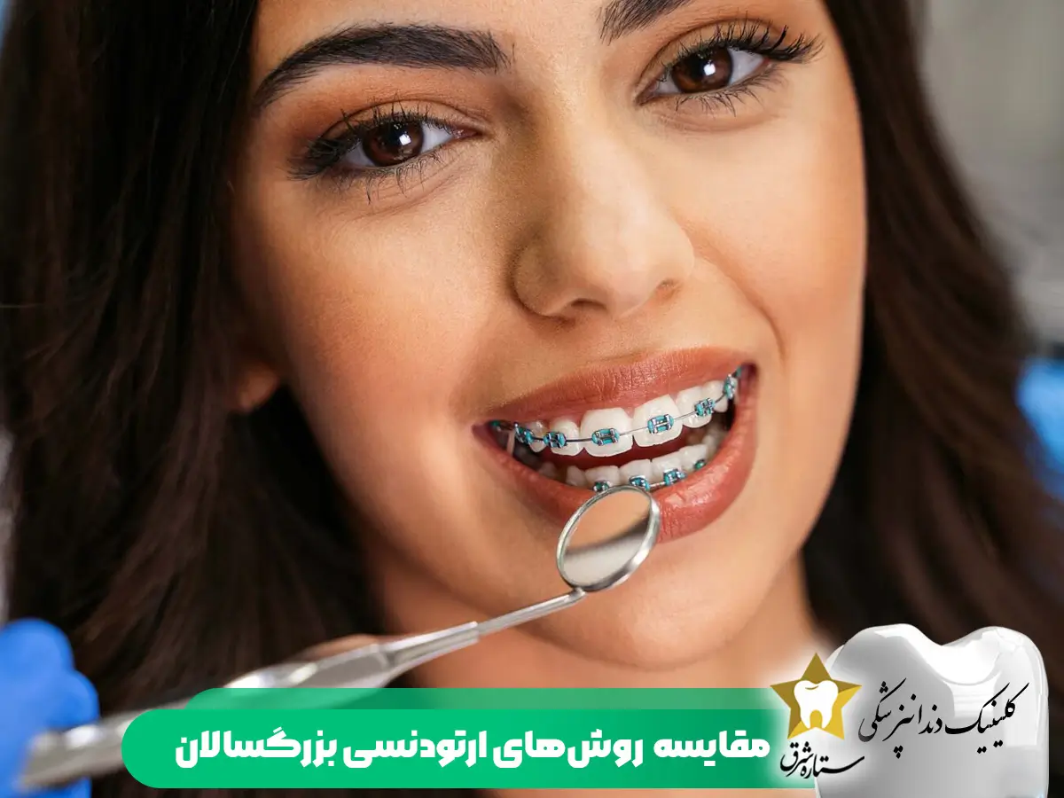 مقایسه روش های ارتودنسی بزرگسالی