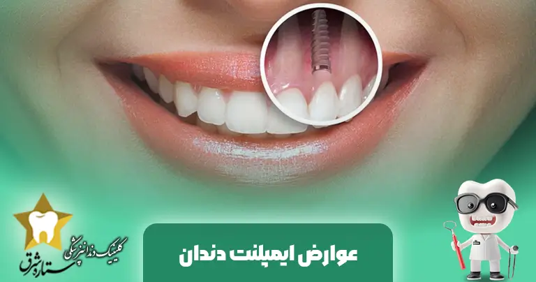 عوارش ایمپلنت دندان