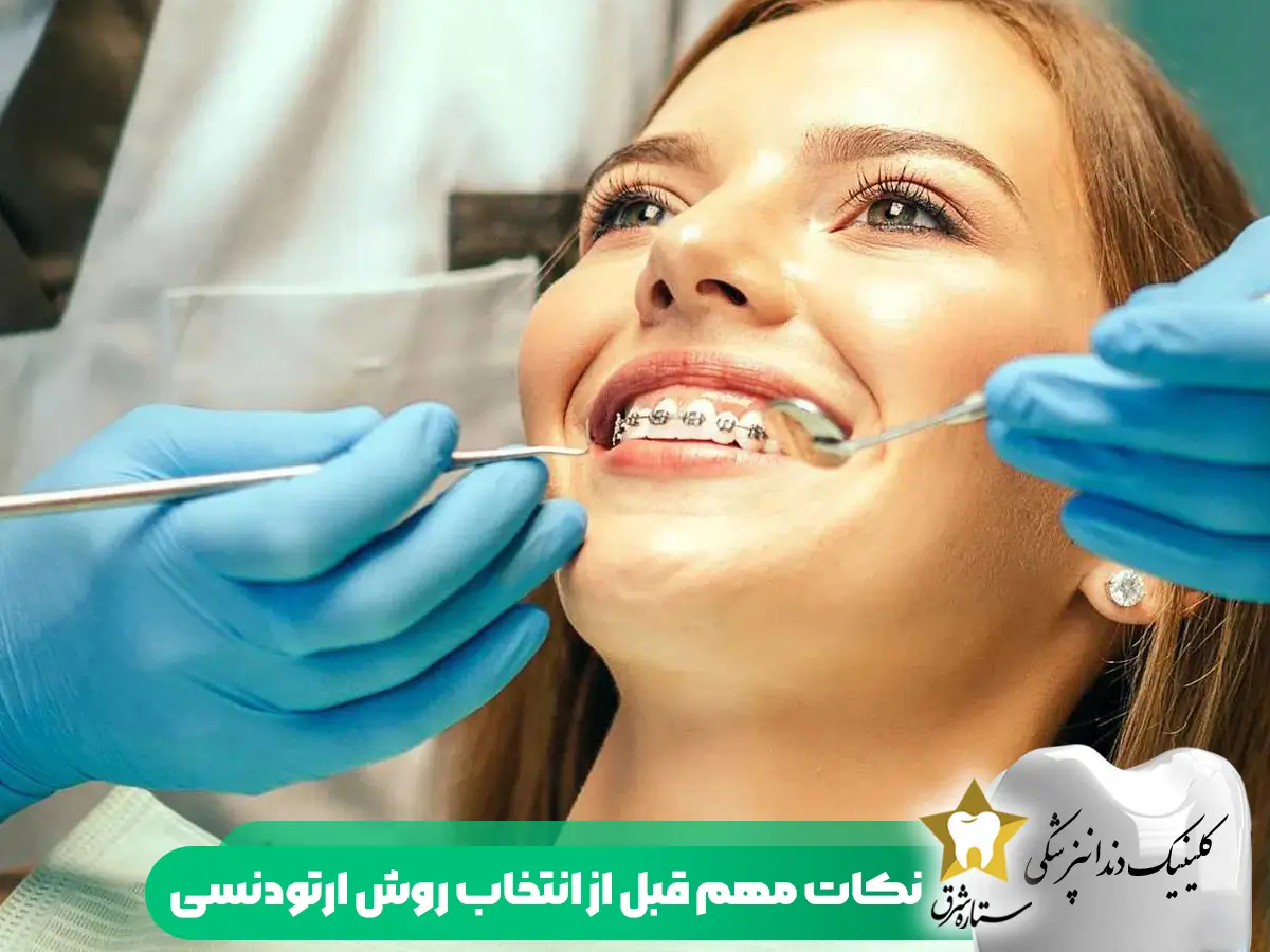 نکات مهم قبل از انتخاب روش ارتودنسی