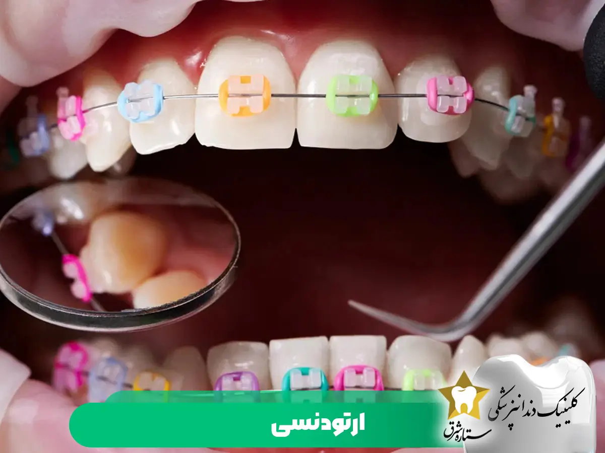 ارتودنسی