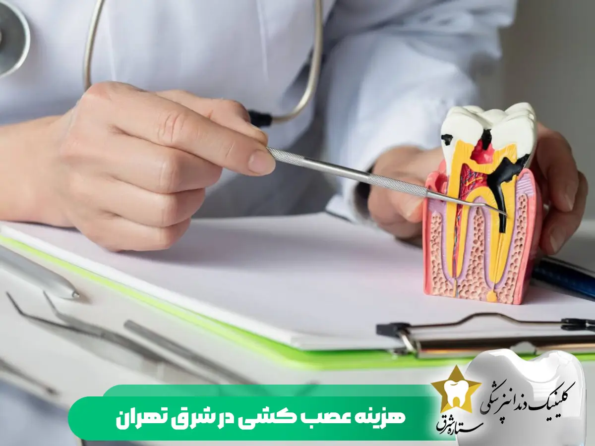 هزینه عصب کشی در شرق تهران