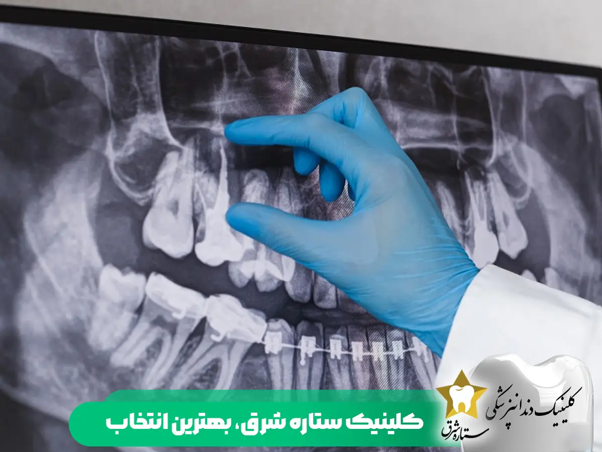 کلینیک ستاره شرق،بهترین انتخاب