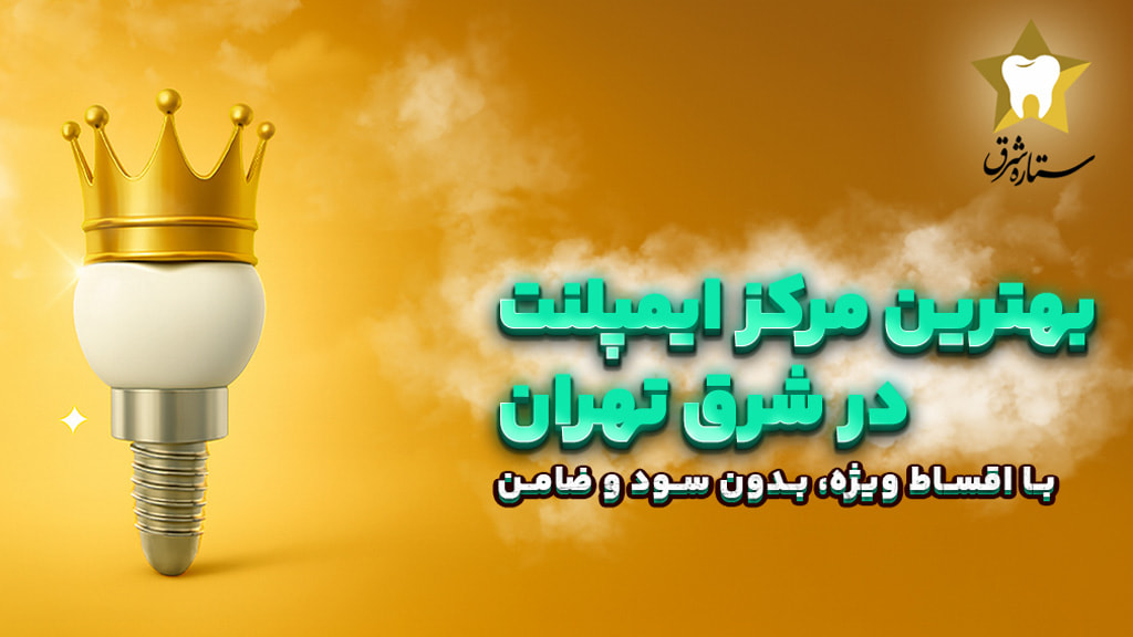 ایمپلنت قسطی