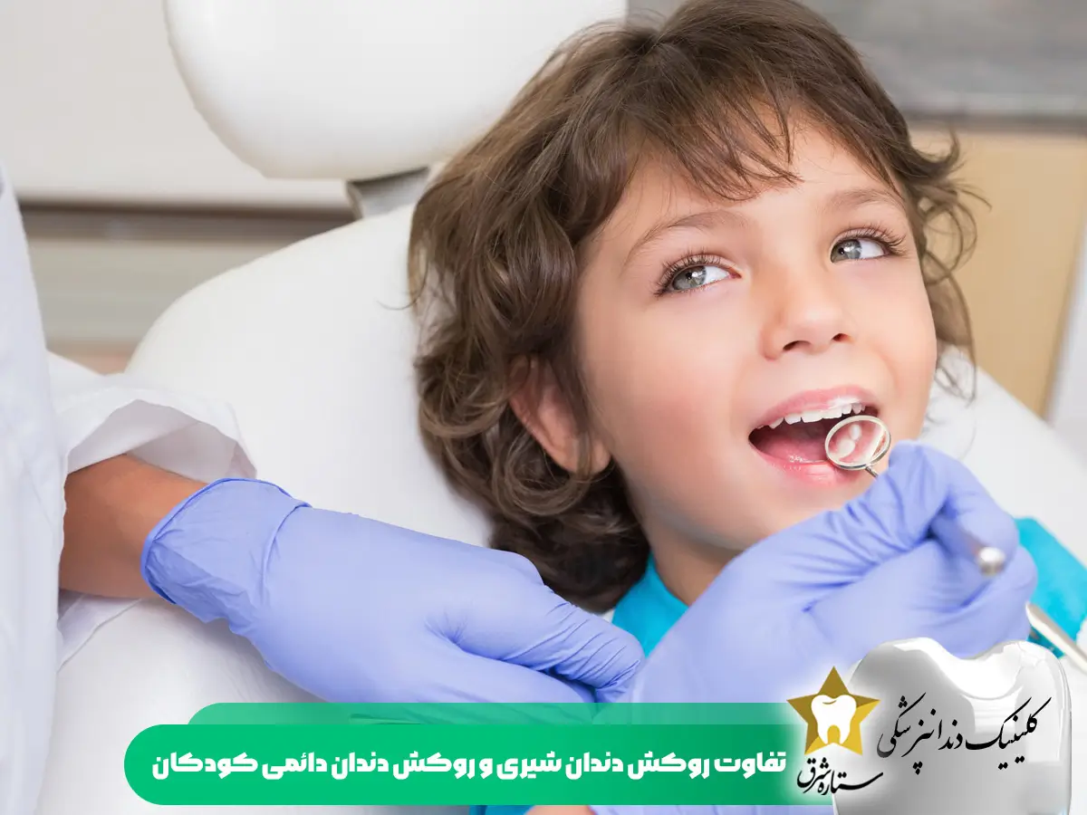 تفاوت روکش دندان شیری و روکش دندان دائمی در کودکان 