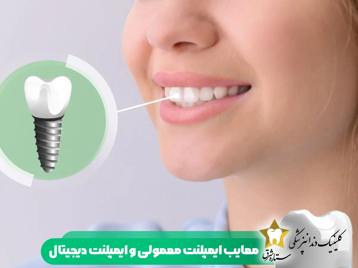 معایب ایمپلنت معمولی و ایمپلنت دیجیتال