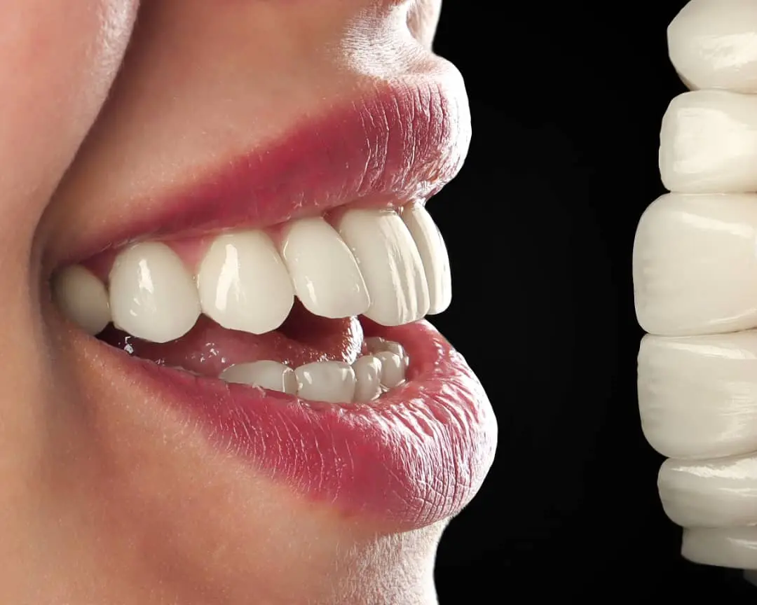 نمونه کار ۴