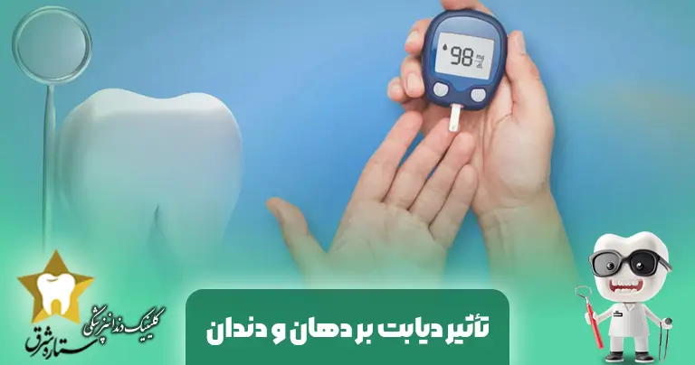 تأثیر دیابت بر دهان و دندان | علائم، عفونت‌ها و روش‌های درمان