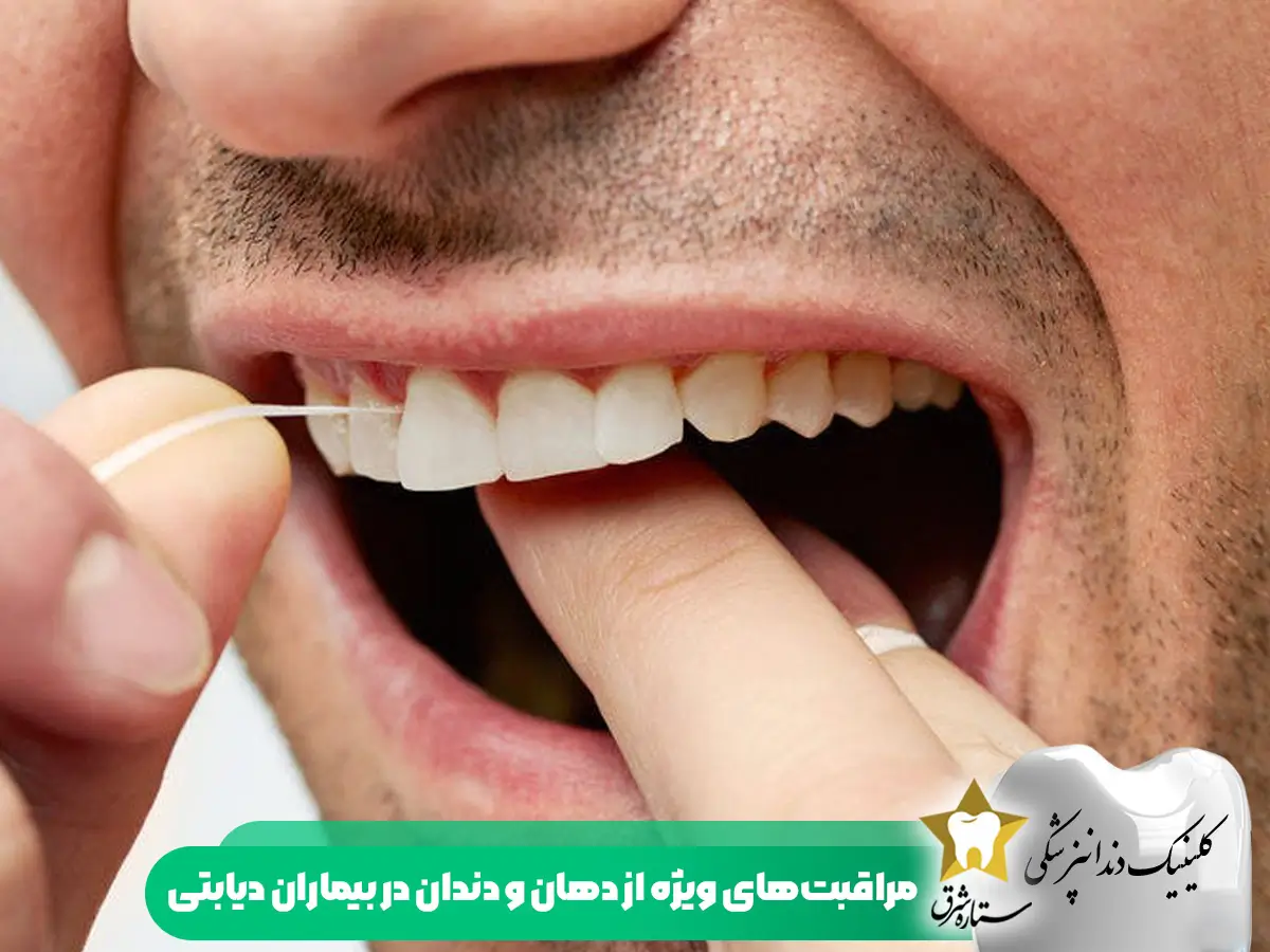 مراقبت های ویژه از دهان و دندان در بیماران دیابتی