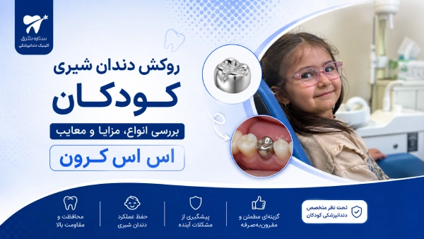 روکش دندان شیری کودکان؛ بررسی انواع، مزایا و معایب اس اس کرون