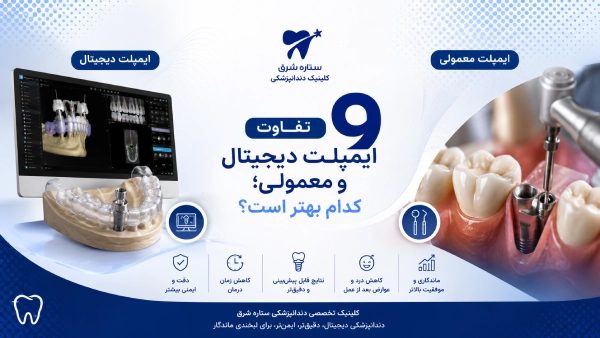 ۹ تفاوت ایمپلنت دیجیتال و معمولی؛ کدام بهتر است؟