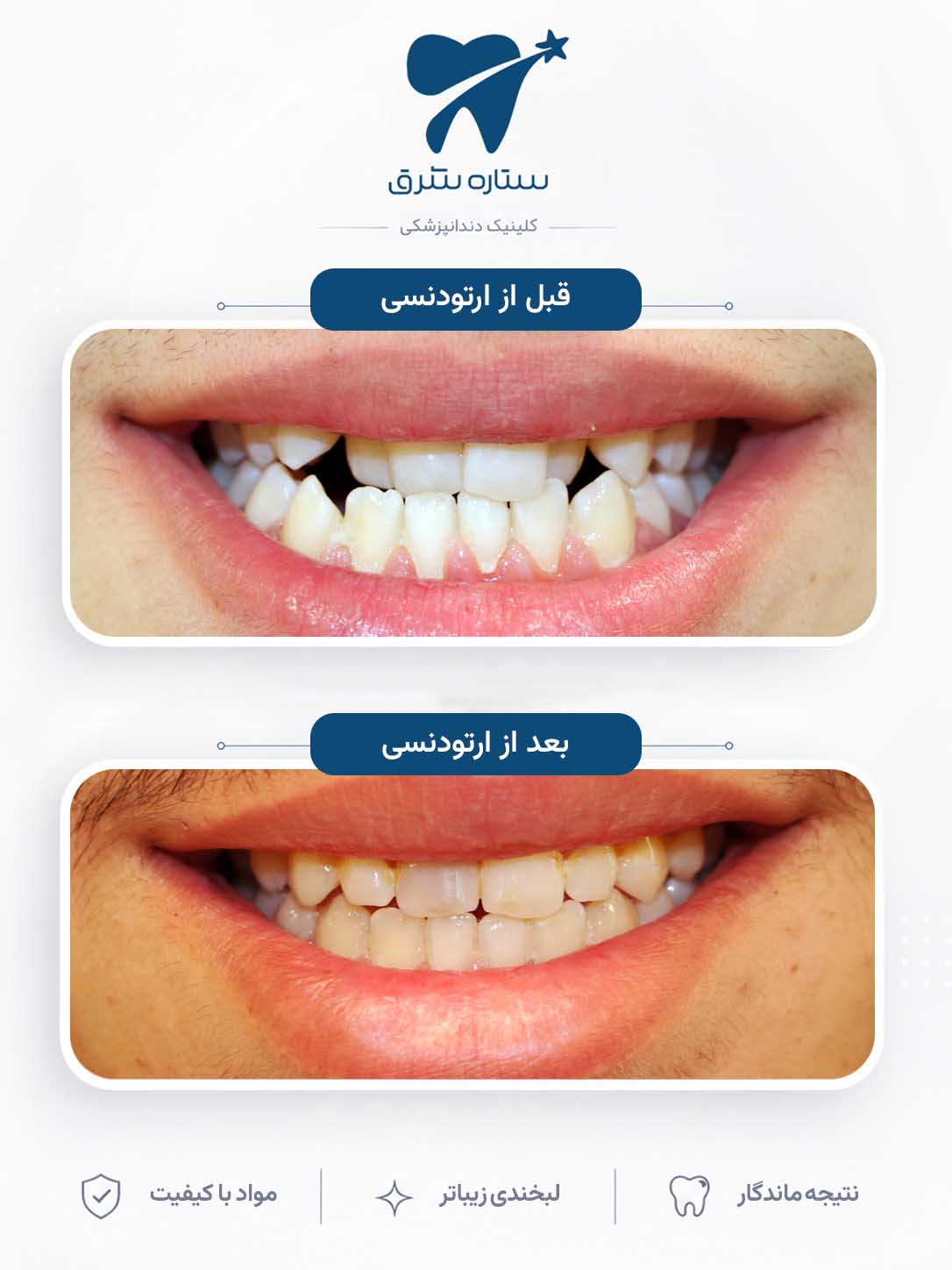 نمونه کار ارتودنسی ستاره شرق ۲