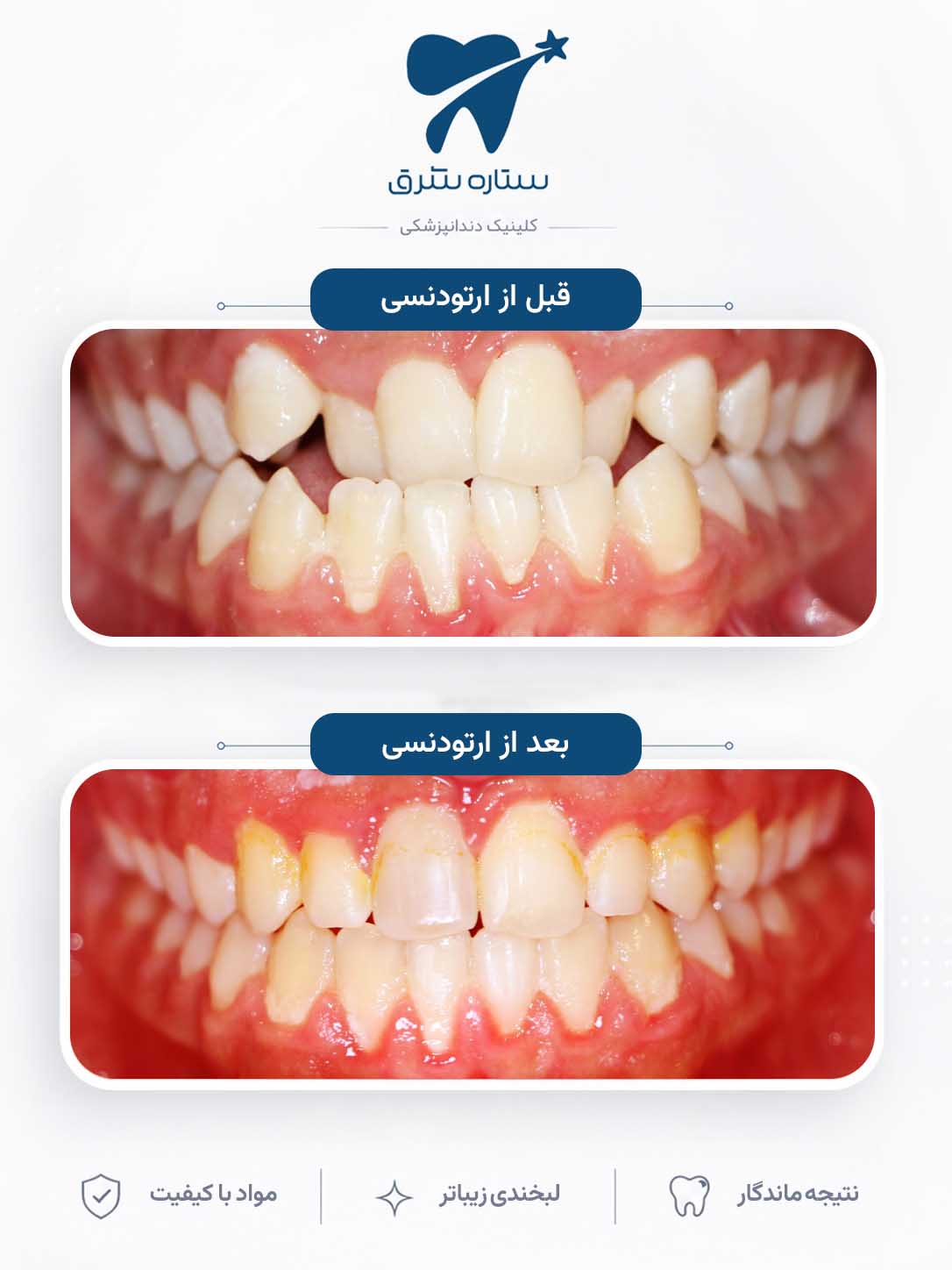 نمونه کار ارتودنسی ستاره شرق ۳