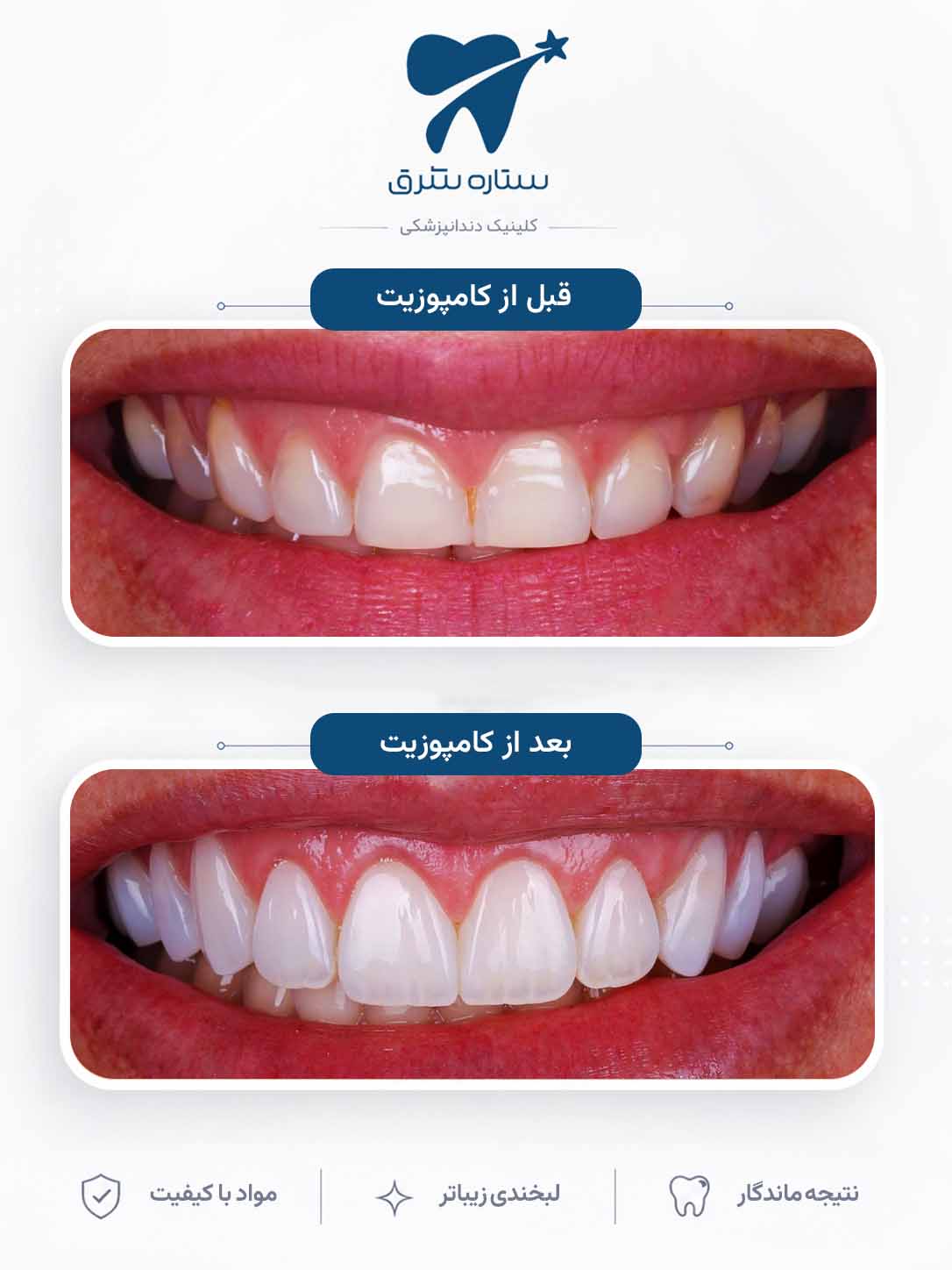 تصویر ترکیبی قبل و بعد درمان