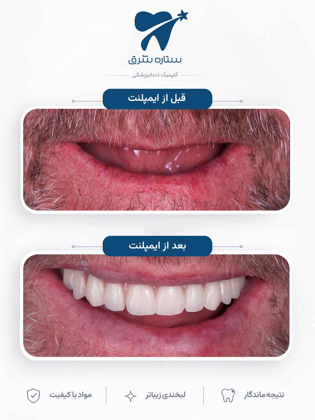 نمونه کار ارتودنسی ستاره شرق ۳