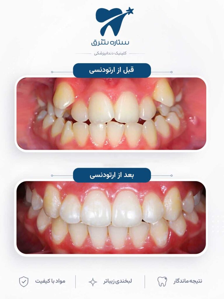 ارتودنسی دندان