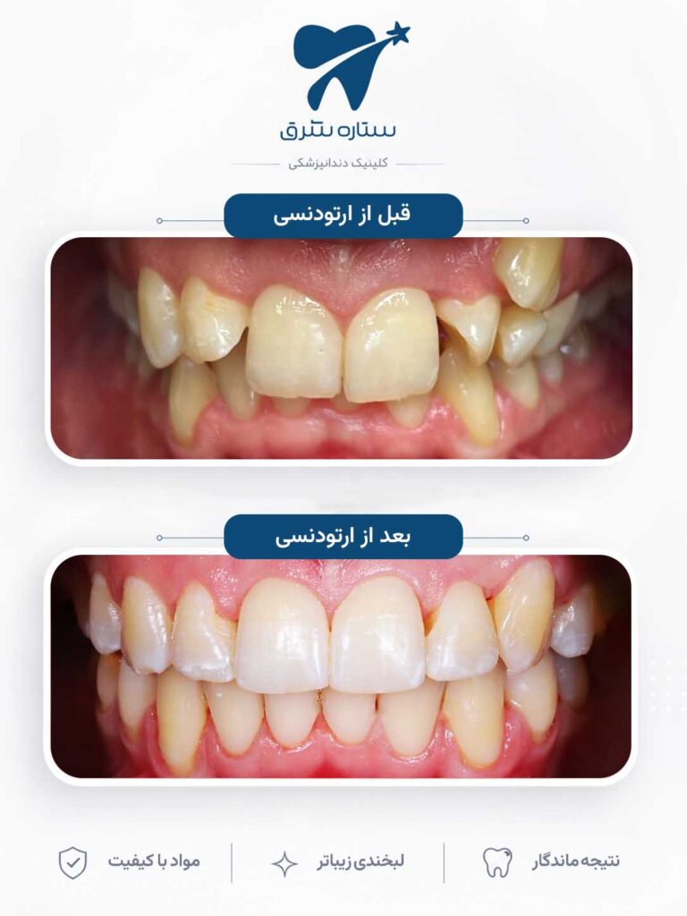 ارتودنسی دندان