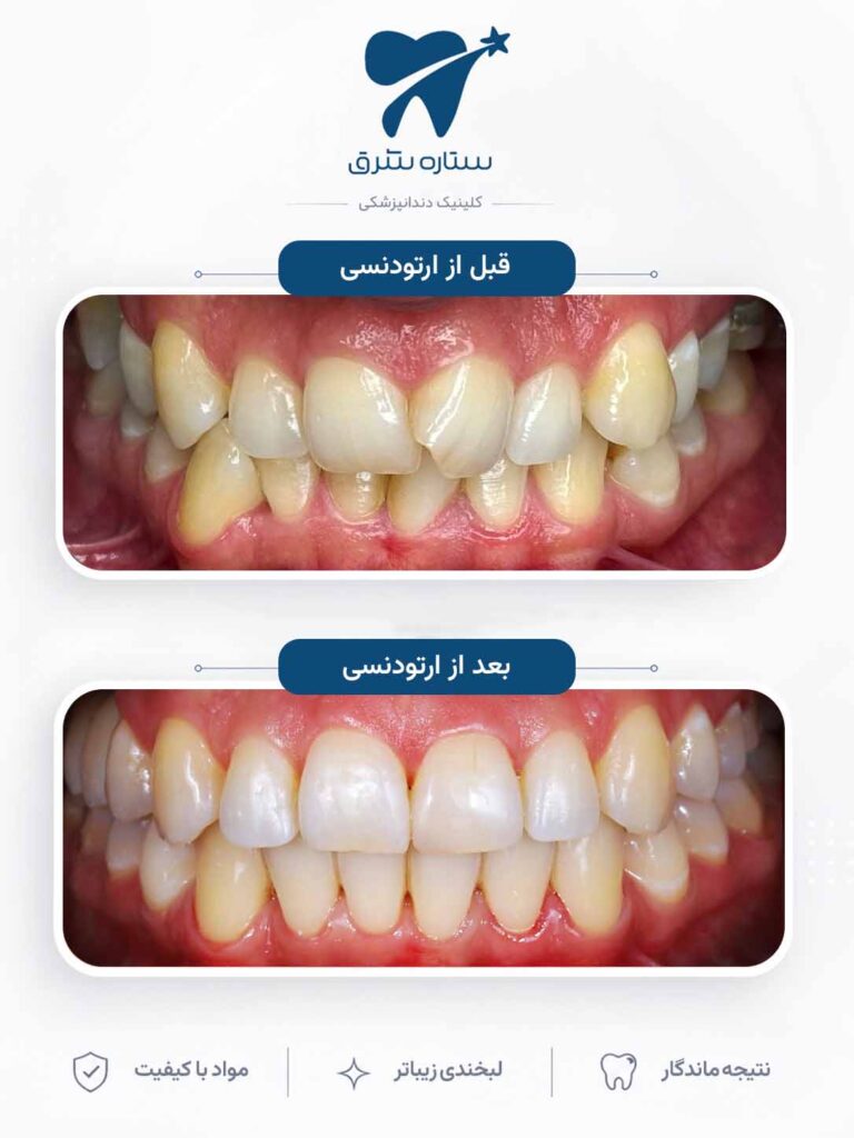 ارتودنسی دندان