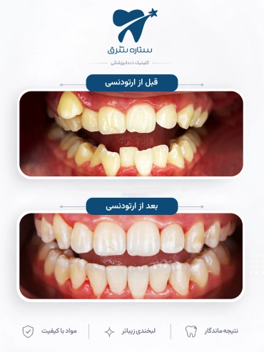 ارتودنسی