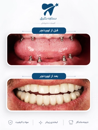 اووردنچر