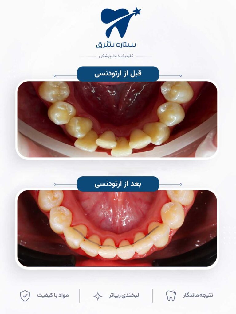 ارتودنسی دندان
