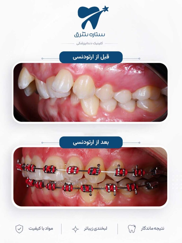 ارتودنسی دندان