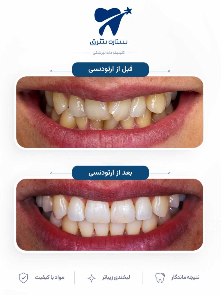 ارتودنسی دندان