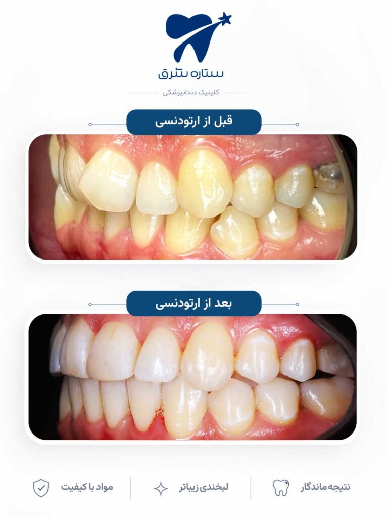 ارتودنسی دندان