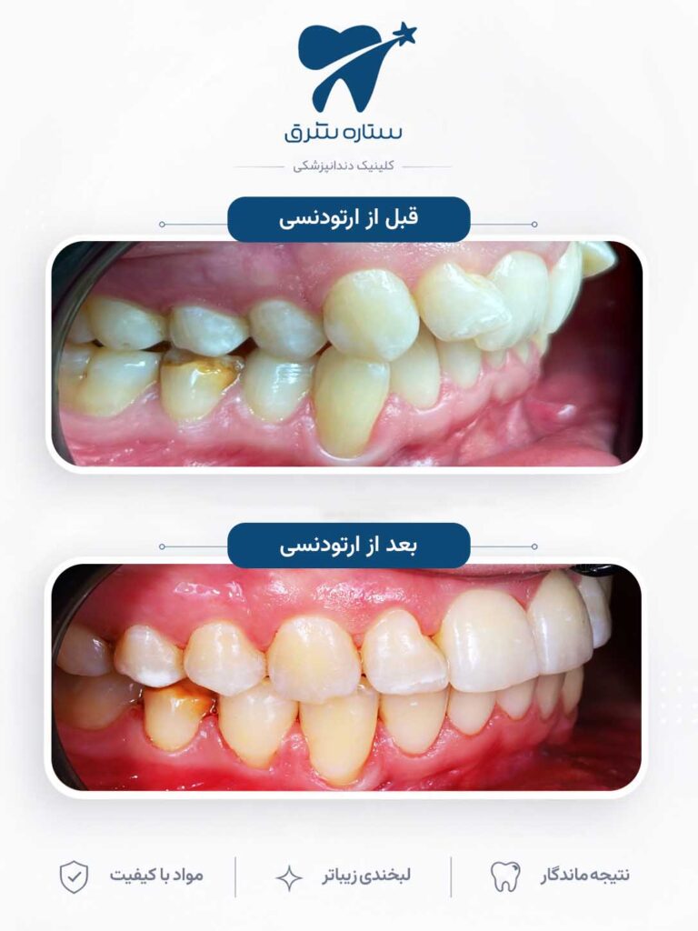 ارتودنسی دندان