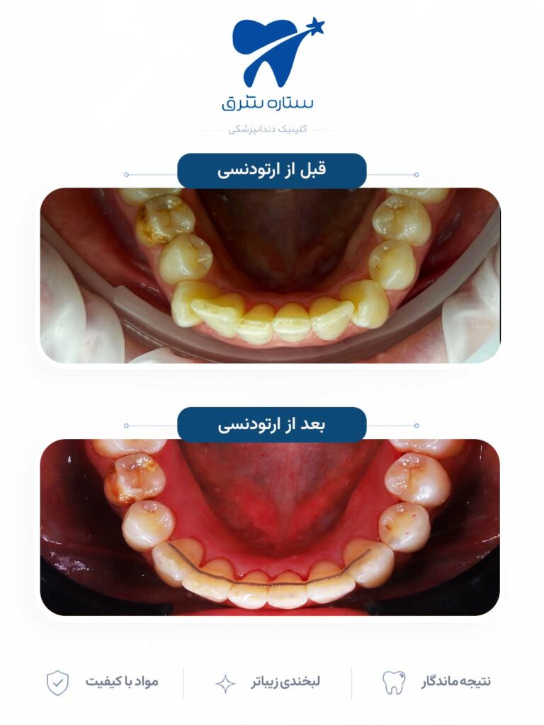 ارتودنسی دندان