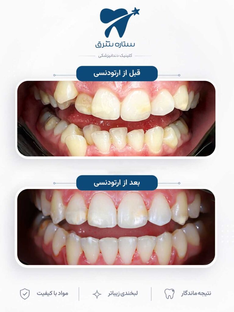 ارتودنسی دندان