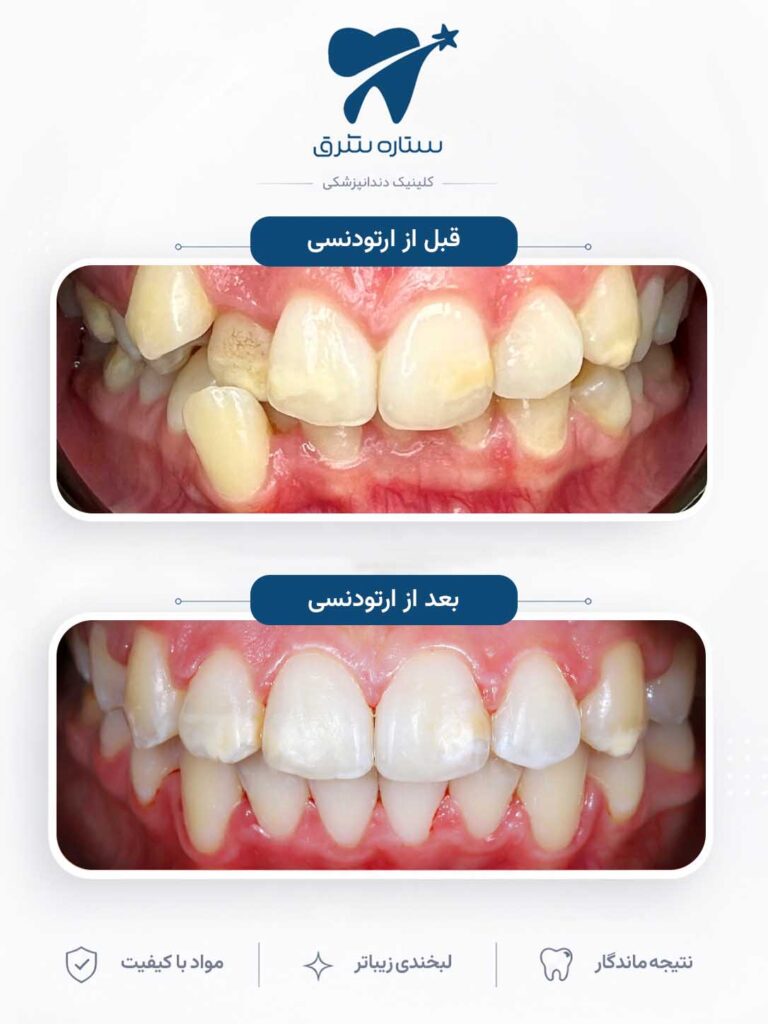 ارتودنسی دندان