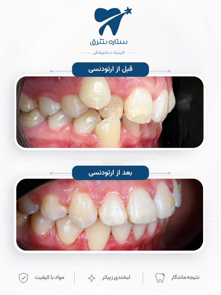 ارتودنسی دندان
