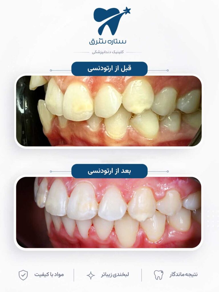 ارتودنسی دندان