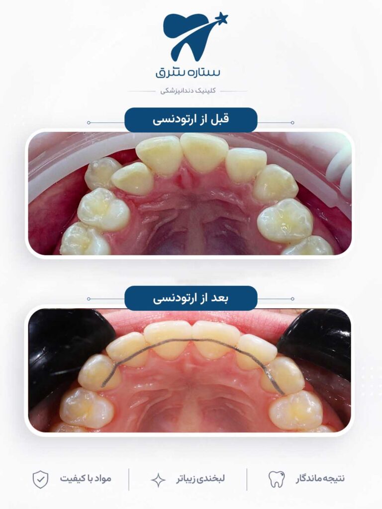 ارتودنسی دندان
