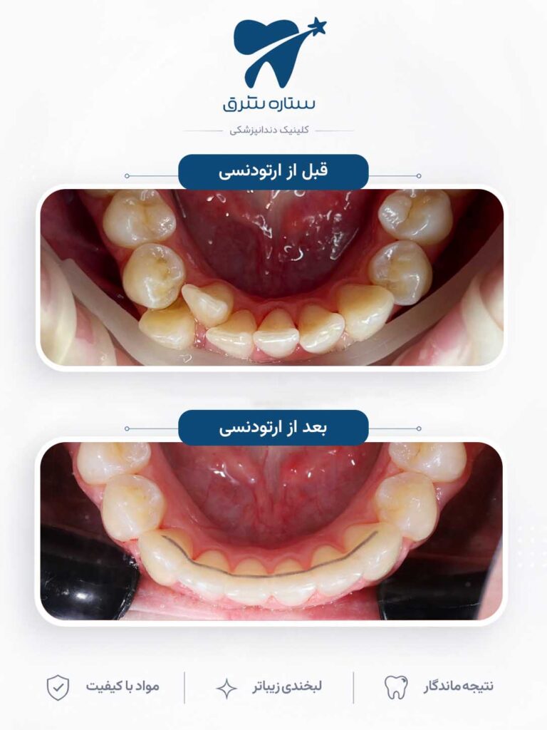 ارتودنسی دندان