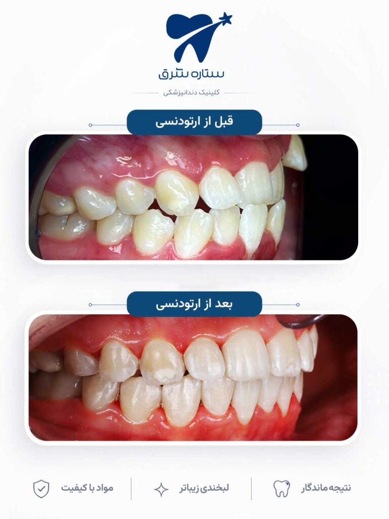 ارتودنسی دندان
