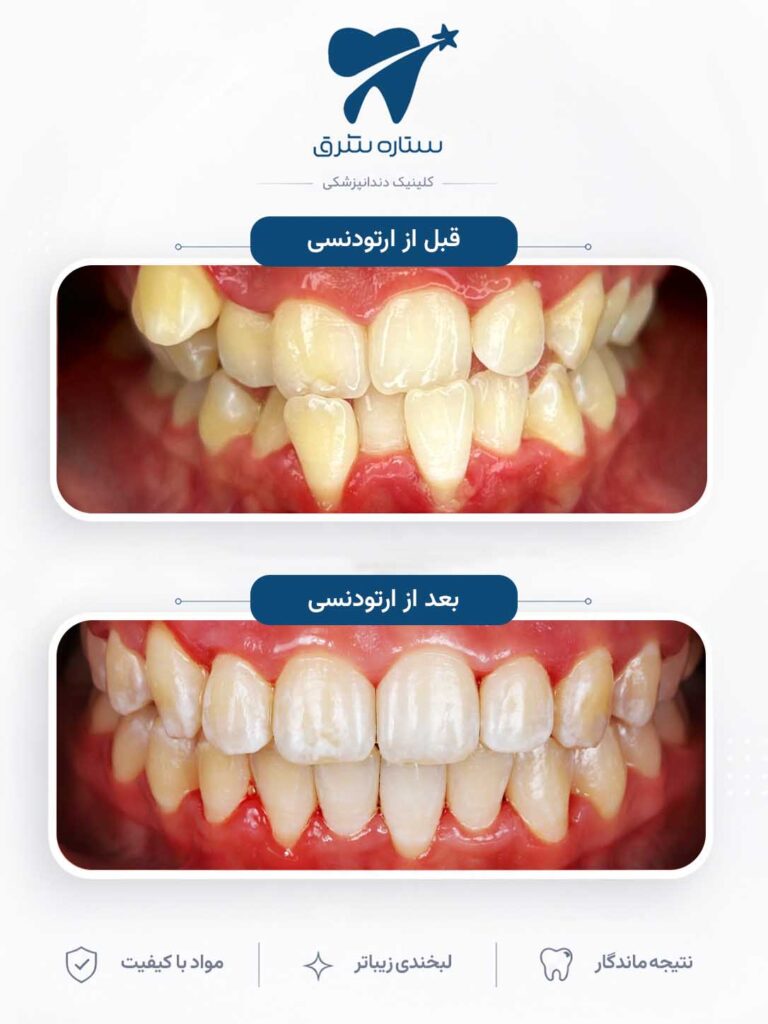 ارتودنسی دندان