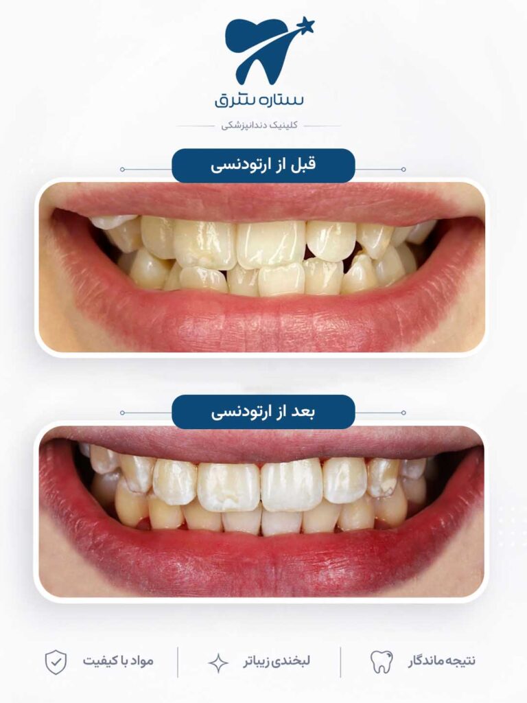 ارتودنسی دندان