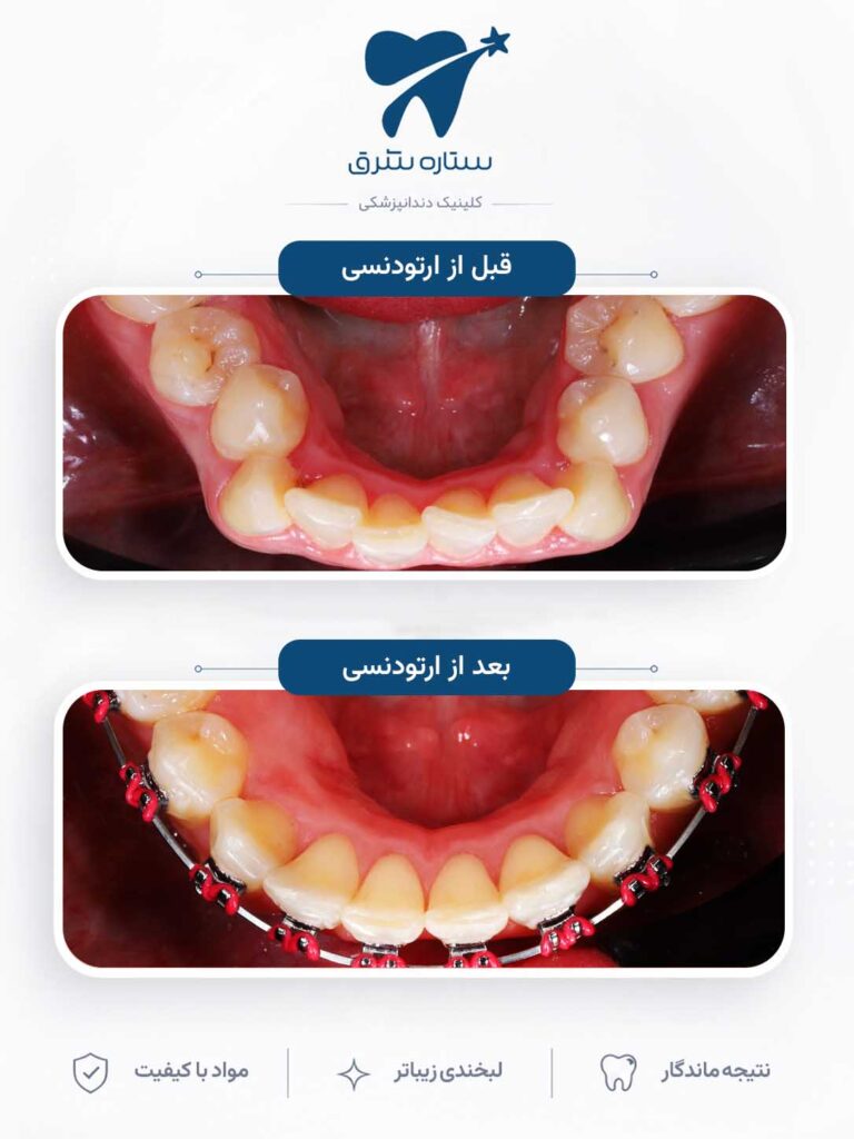 ارتودنسی دندان
