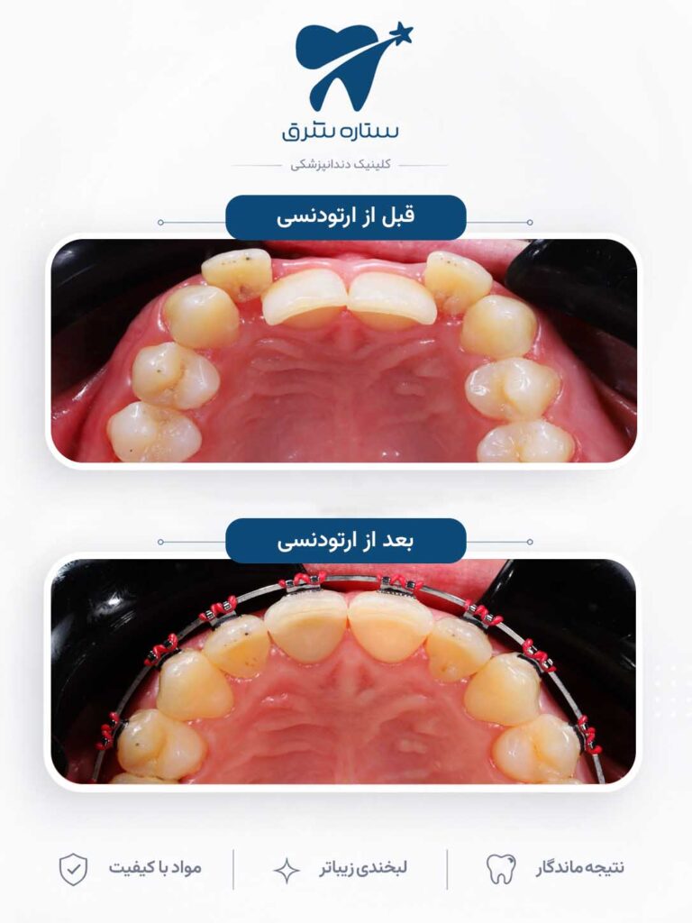 ارتودنسی دندان