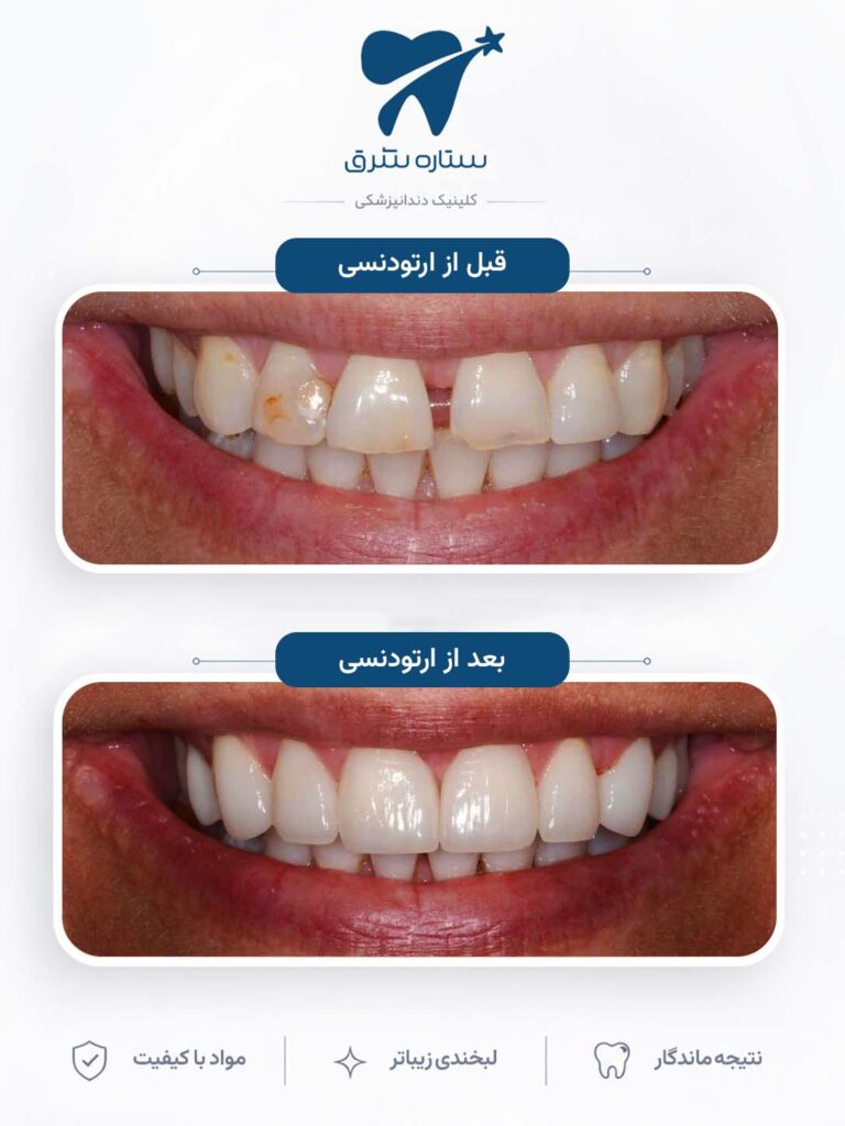 ارتودنسی دندان