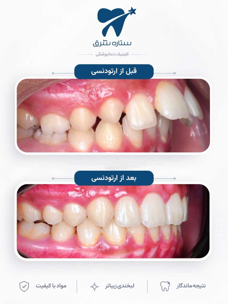ارتودنسی دندان