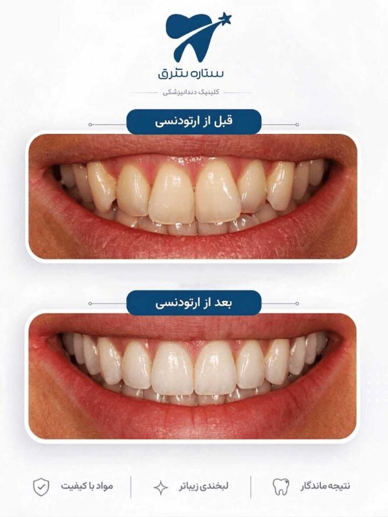 ارتودنسی دندان