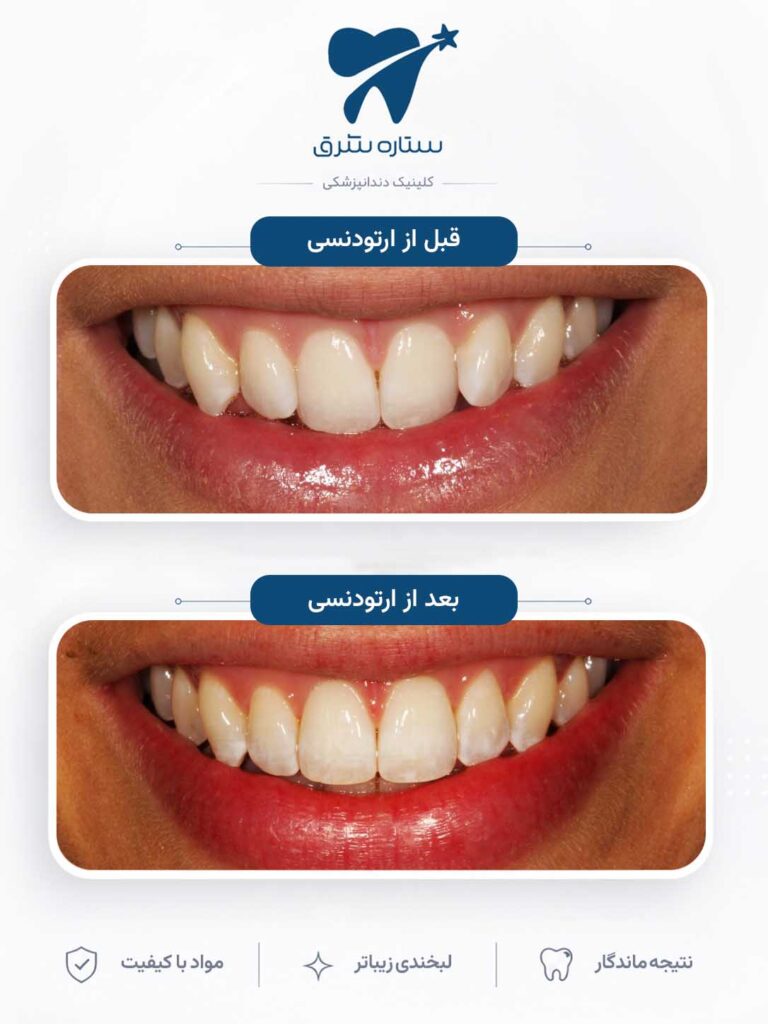 ارتودنسی دندان