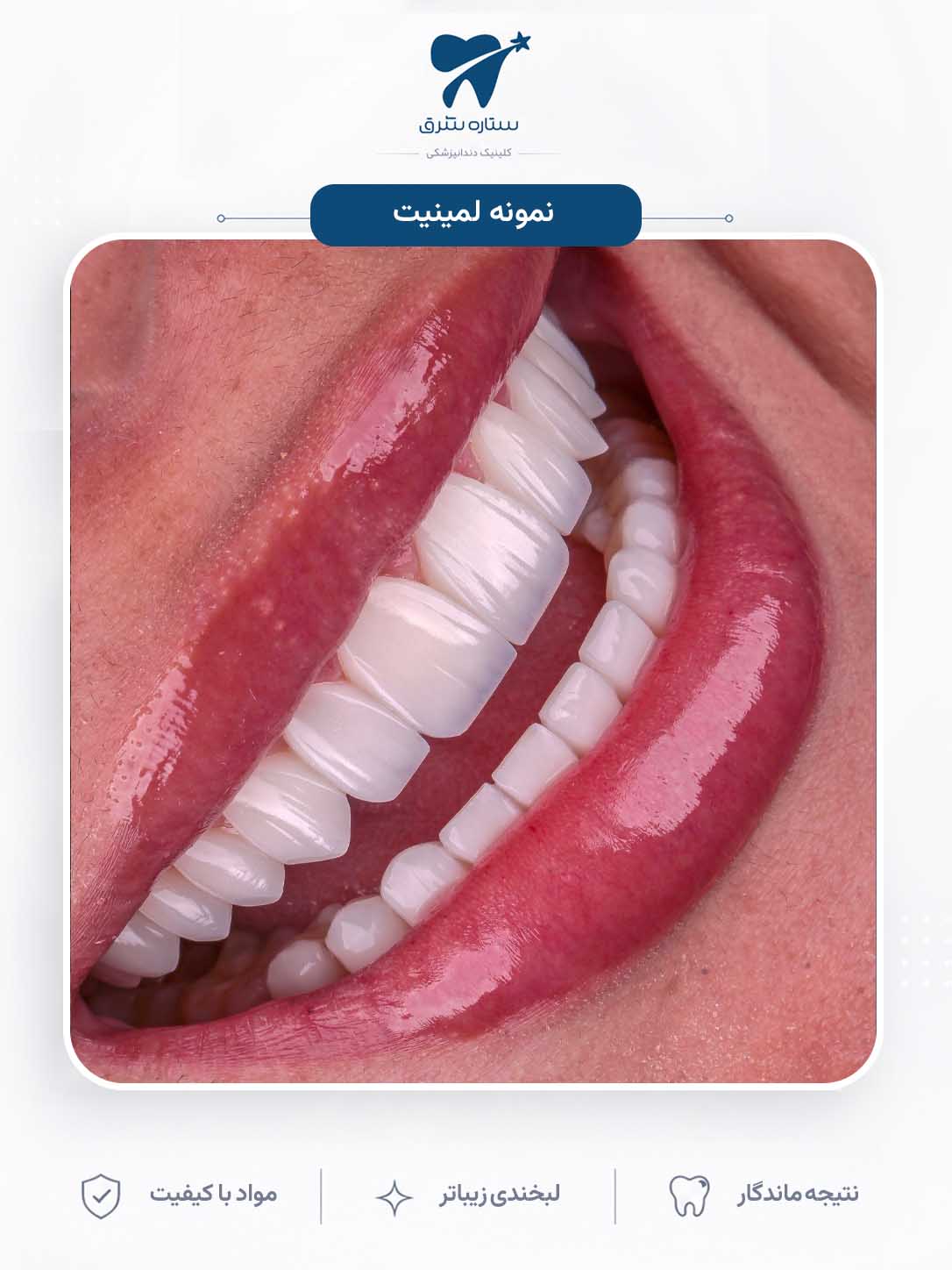 نمونه کار ارتودنسی ستاره شرق ۱