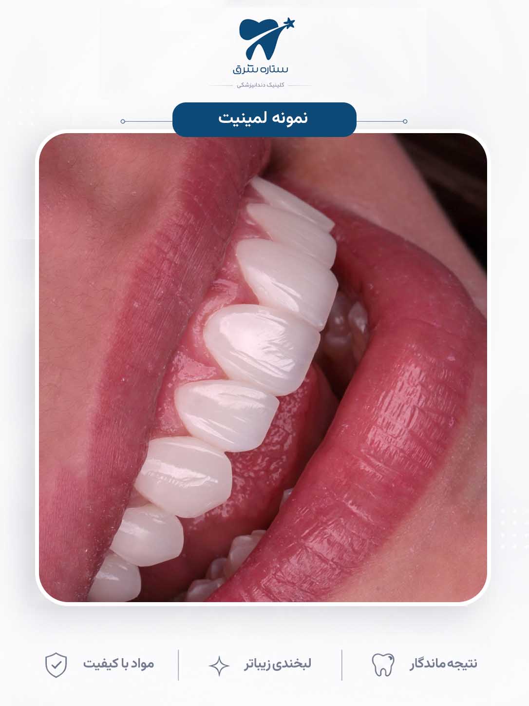 نمونه کار ارتودنسی ستاره شرق ۳